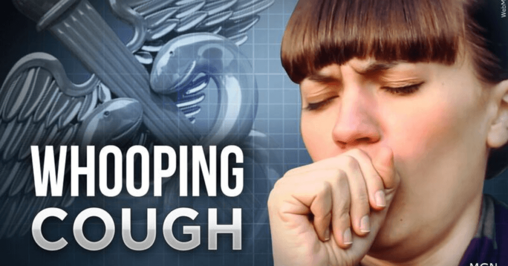 whooping-cough-symptoms-causes-treatment-and-prevention