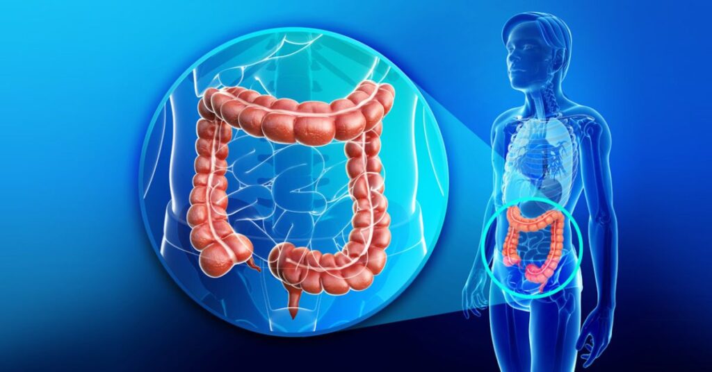 colon-cancer-symptoms-stages-diagnosis-and-best-treatment-options